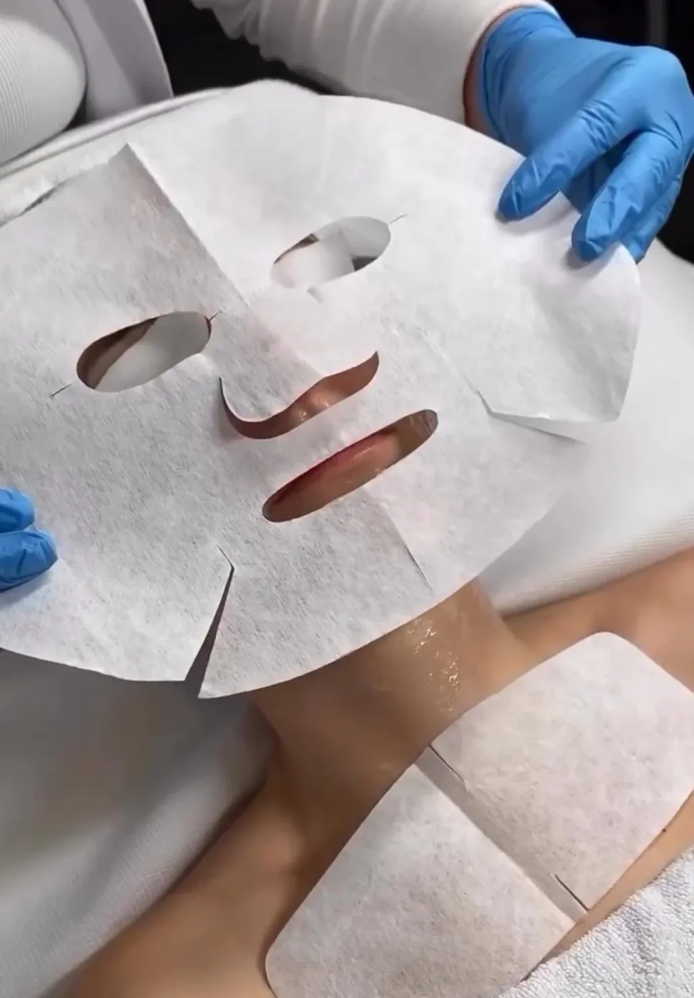 Aplicación de una mascarilla facial de tejido durante un tratamiento antiedad.